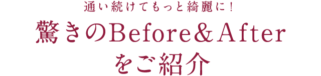 通い続けてもっと綺麗に！ 驚きのBefore＆Afterをご紹介