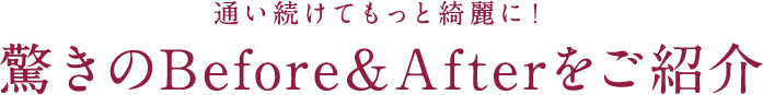 通い続けてもっと綺麗に！ 驚きのBefore＆Afterをご紹介 